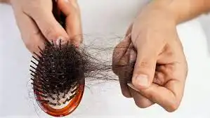 hair fall solution Bangla tips causes treatment natural remedies hair care guide